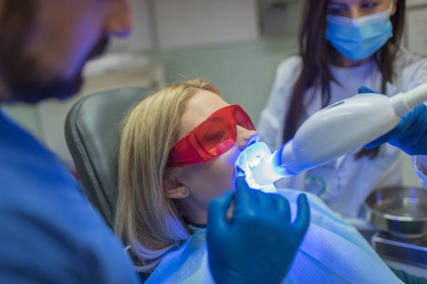 BLANQUEAMIENTO LASER